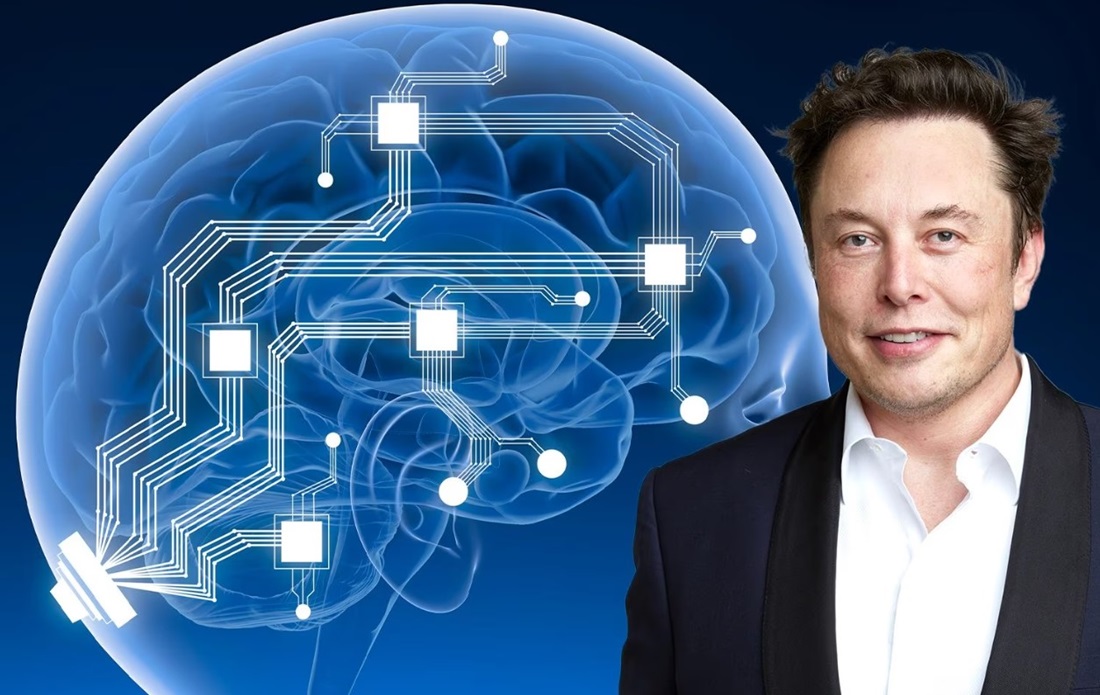 neuralink elon musk impianto essere umano