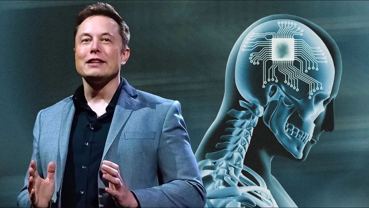 neuralink elon musk microchip cervello
